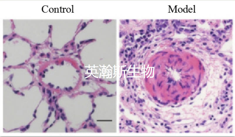 肺动脉高血压模型.jpg