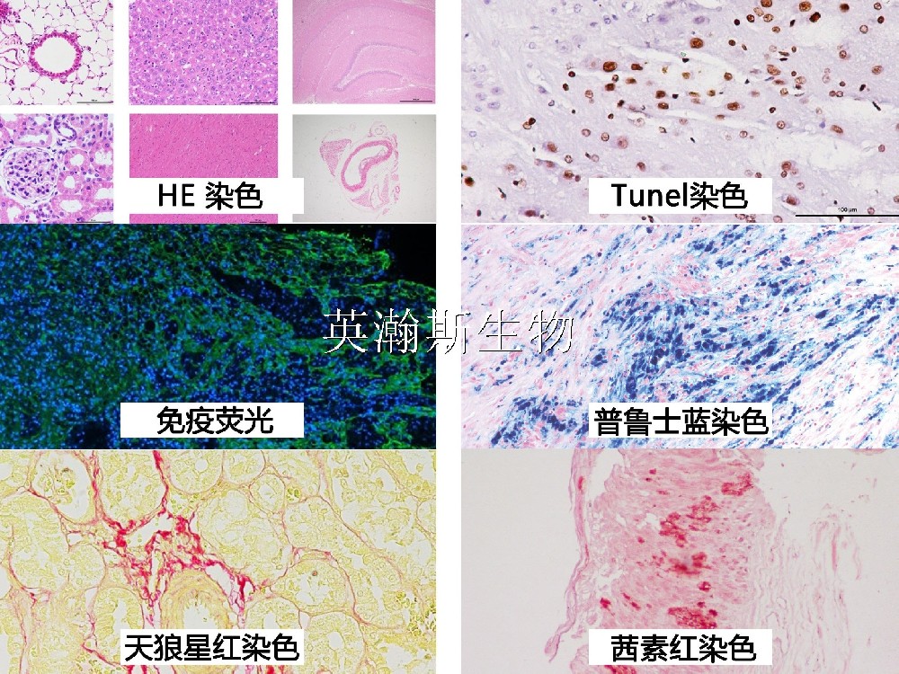 病理图片拼贴_wm.jpg